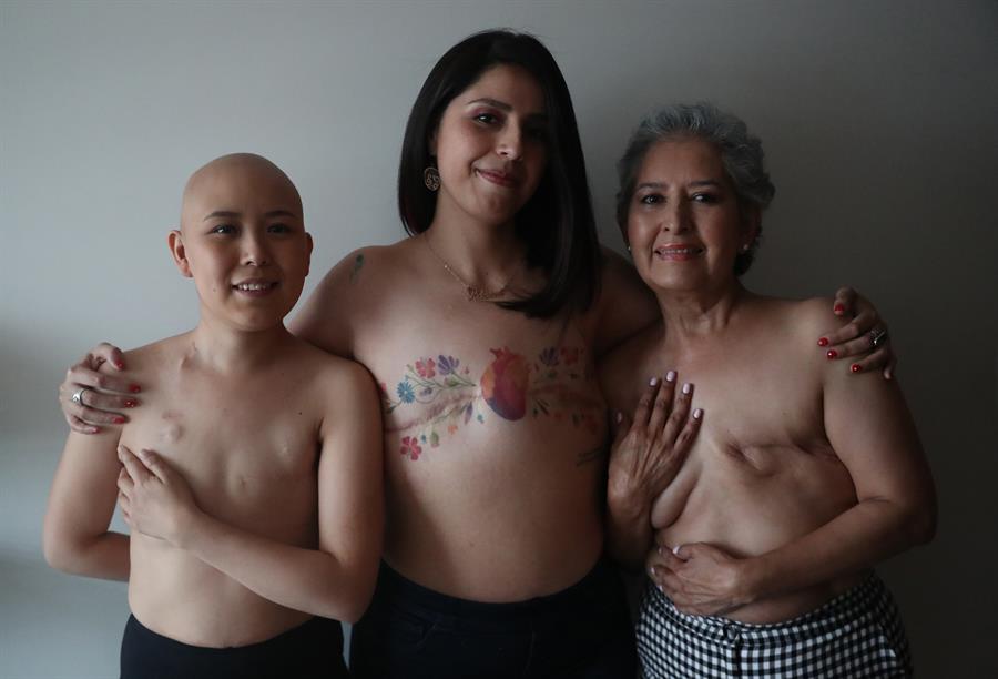 Cáncer de mama en tres generaciones, mucho más que un lazo rosa