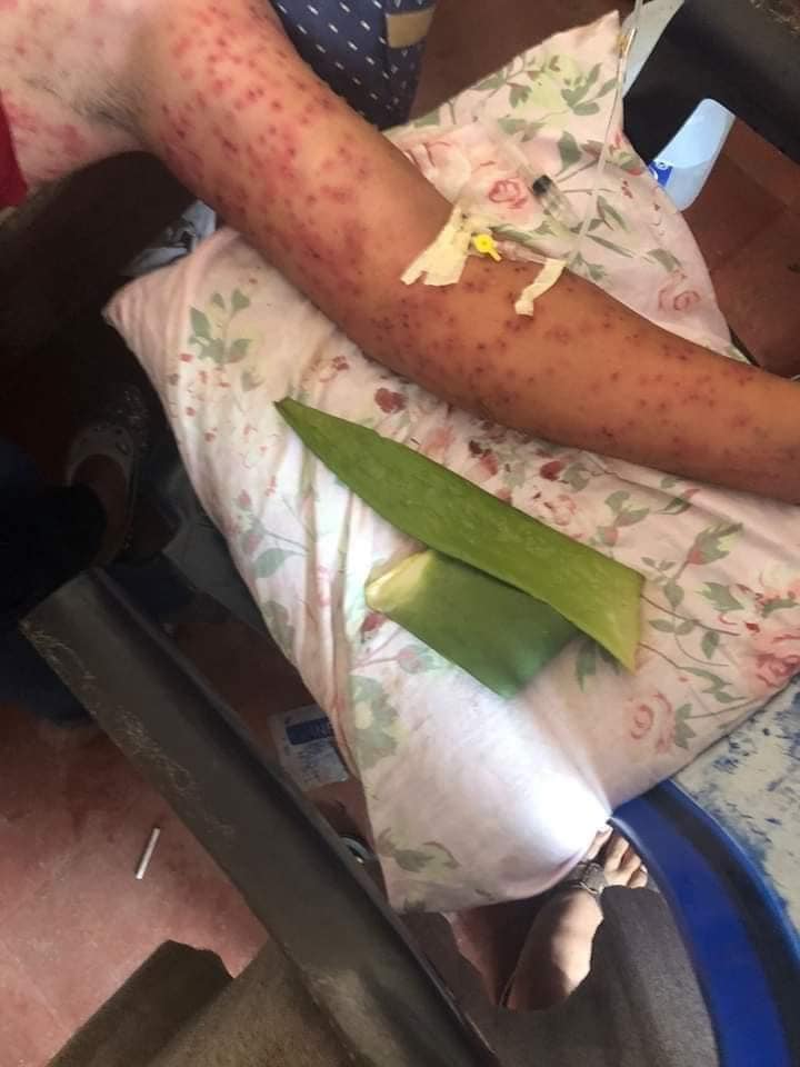 Las picaduras de abejas matan a cuatro pasajeros de un bus que cayó a un abismo