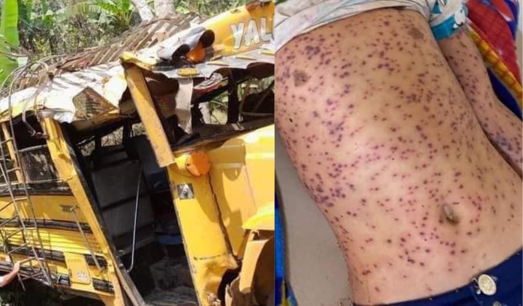 Otras dos personas mueren víctimas de un enjambre de abejas africanas en Jinotega