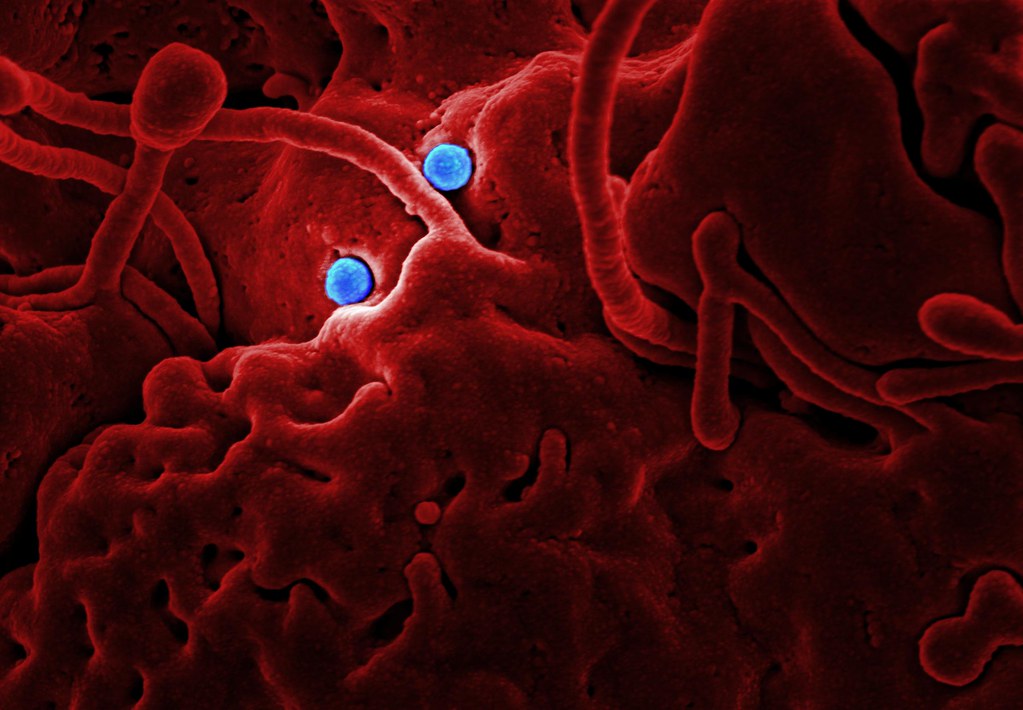Honduras reporta primer caso sospechoso de coronavirus