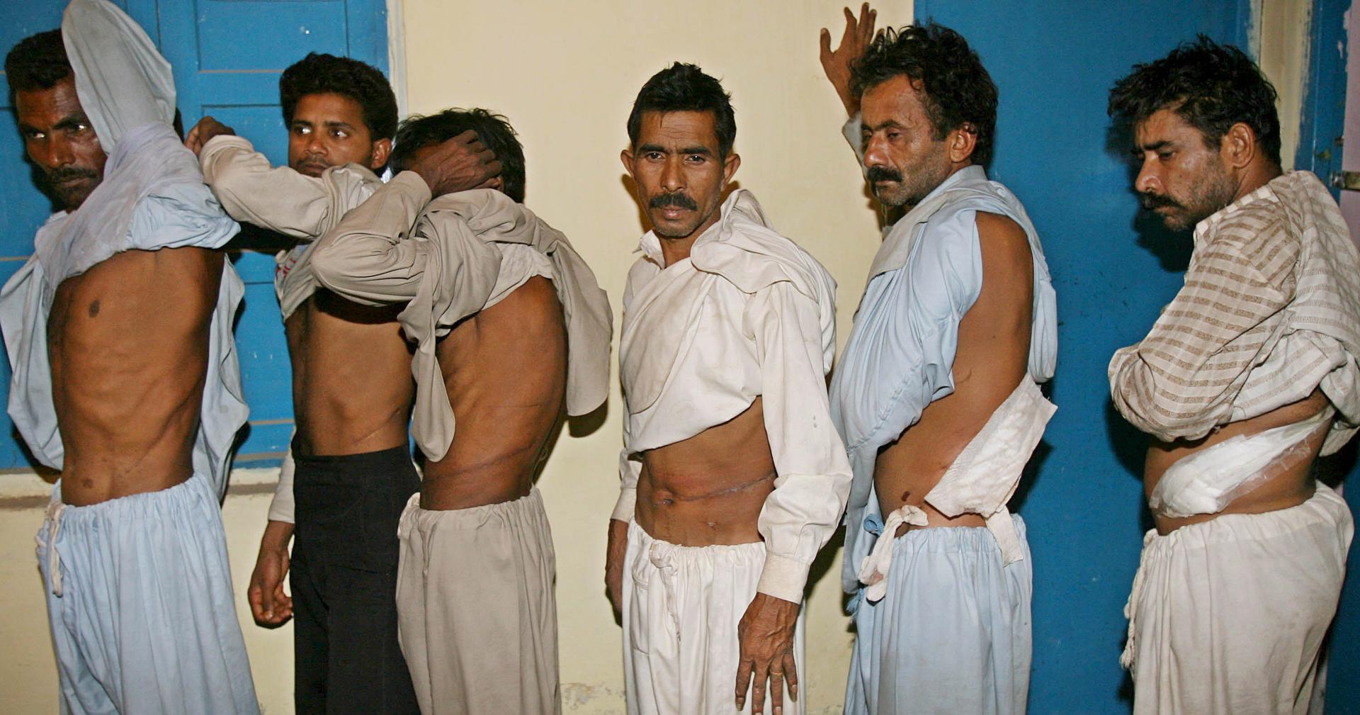 Mafias de ciberestafa en Asia obligan a algunos trabajadores esclavos a vender sus órganos