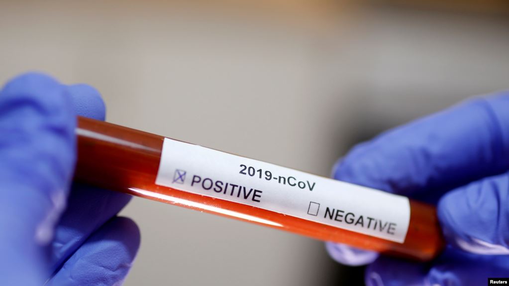 México confirma dos casos de coronavirus