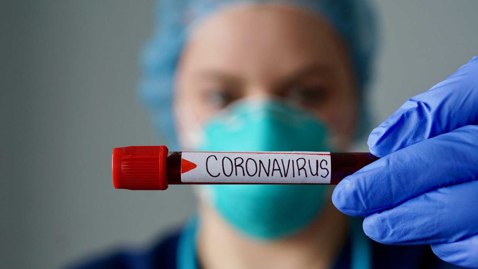 Vacuna contra coronavirus estaría lista a finales de año o principios 2021