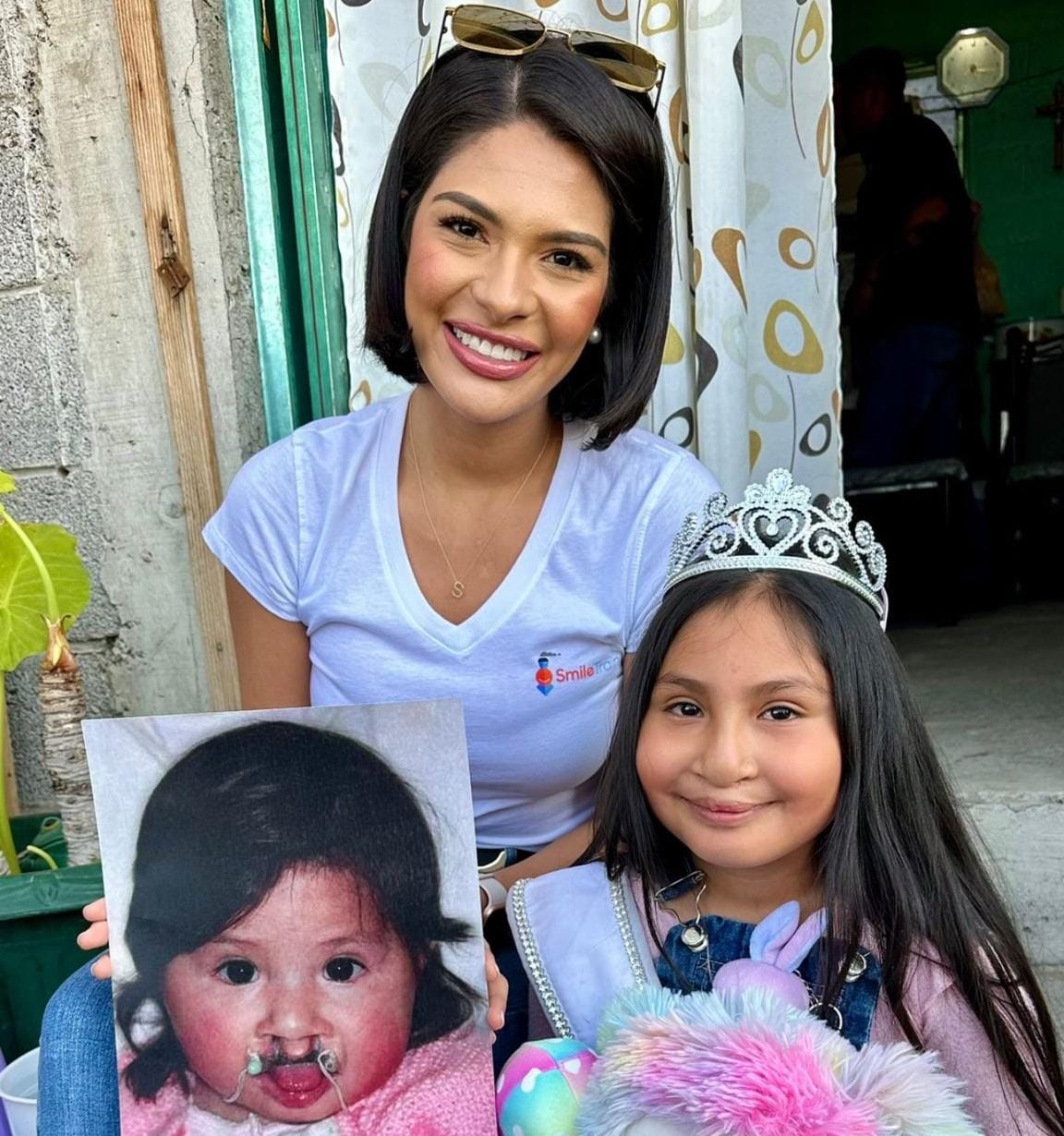 Sheynnis Palacios se suma a causa de niños con fisura de labio palatina