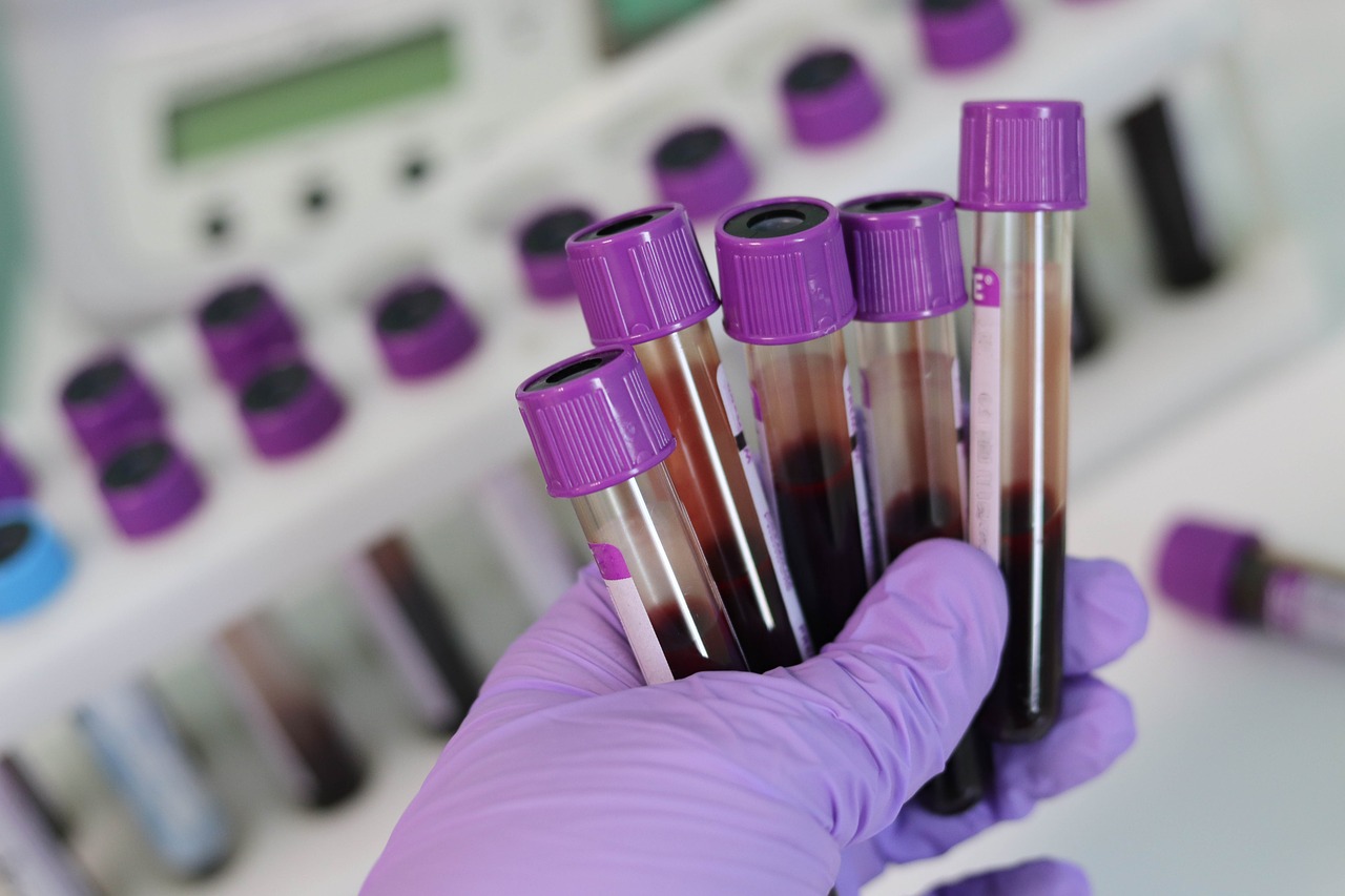 BCIE entregará a Nicaragua 22 mil pruebas rápidas para detectar el Covid-19
