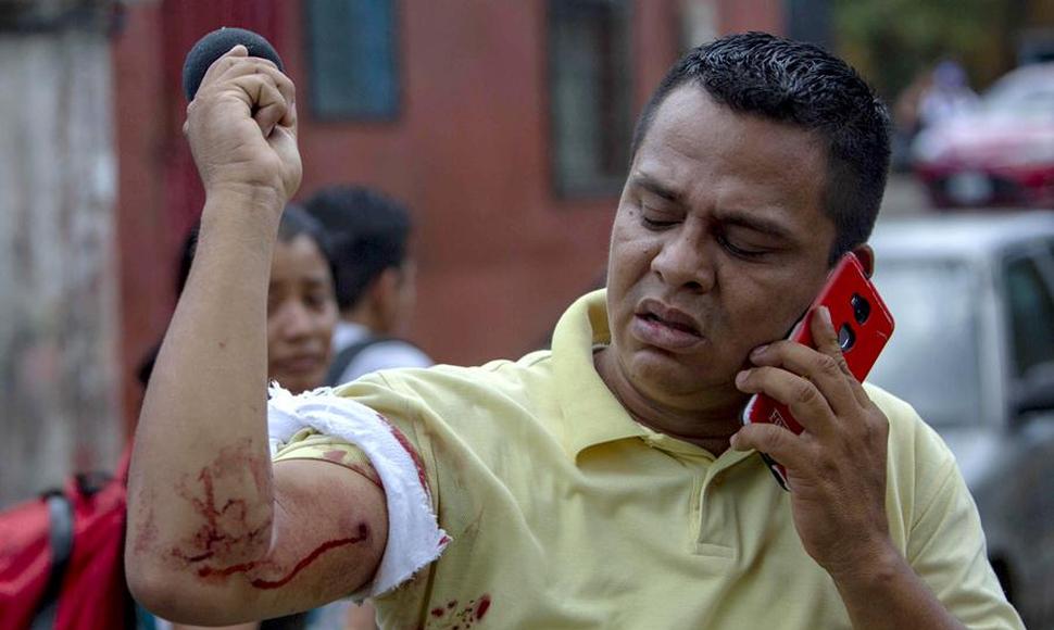 Turbas orteguistas golpean brutalmente a padre del periodista Winston Potosme
