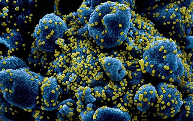 El Covid-19 no daña solo los pulmones sino que puede afectar a otros órganos