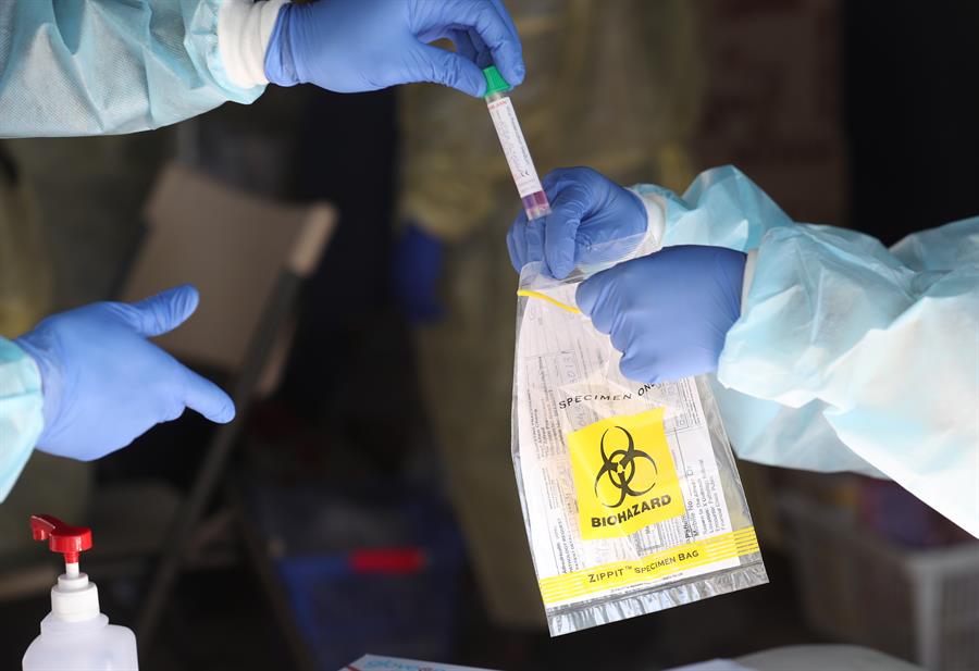 Coronavirus en aumento: Más de diez millones infectados en todo el mundo