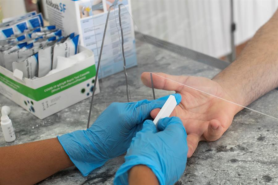 Coronavirus: Más de 954.000 muertes y 30,6 millones de casos