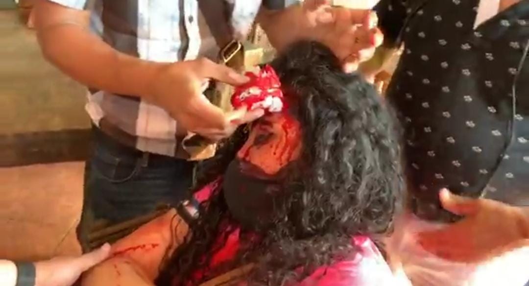 Policía minimiza agresión contra Verónica Chávez y ONU pide investigar el ataque