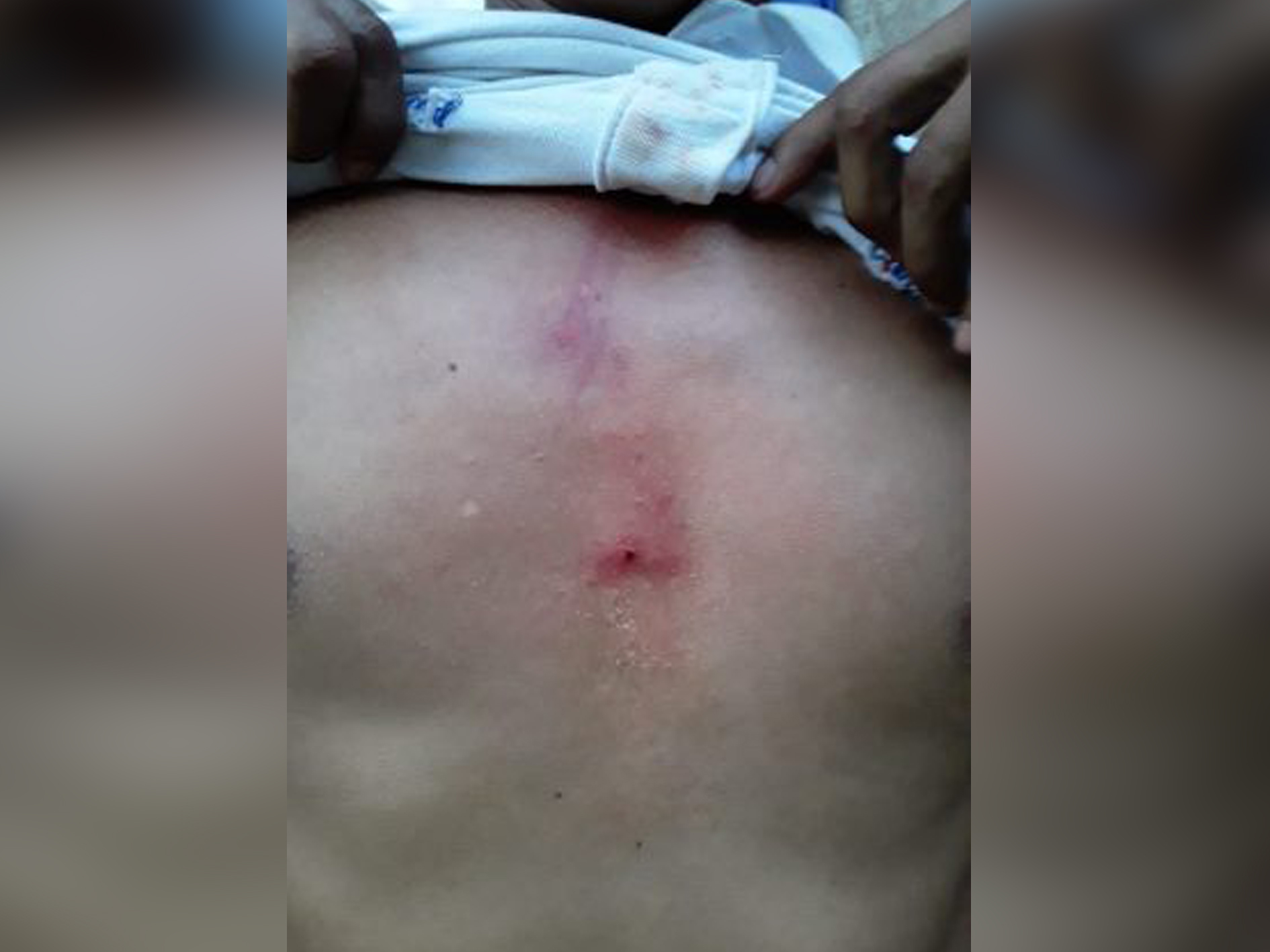 Policía protege a funcionarios orteguistas que agredieron a concejal de CxL en San Rafael del Norte