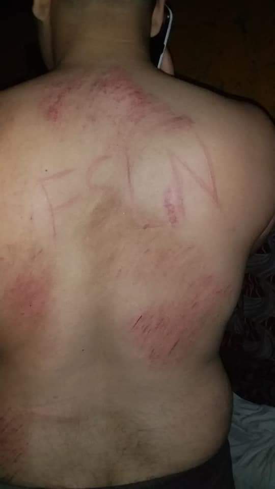 Secuestran, torturan y marcan a joven que participó en protesta contra el régimen orteguista