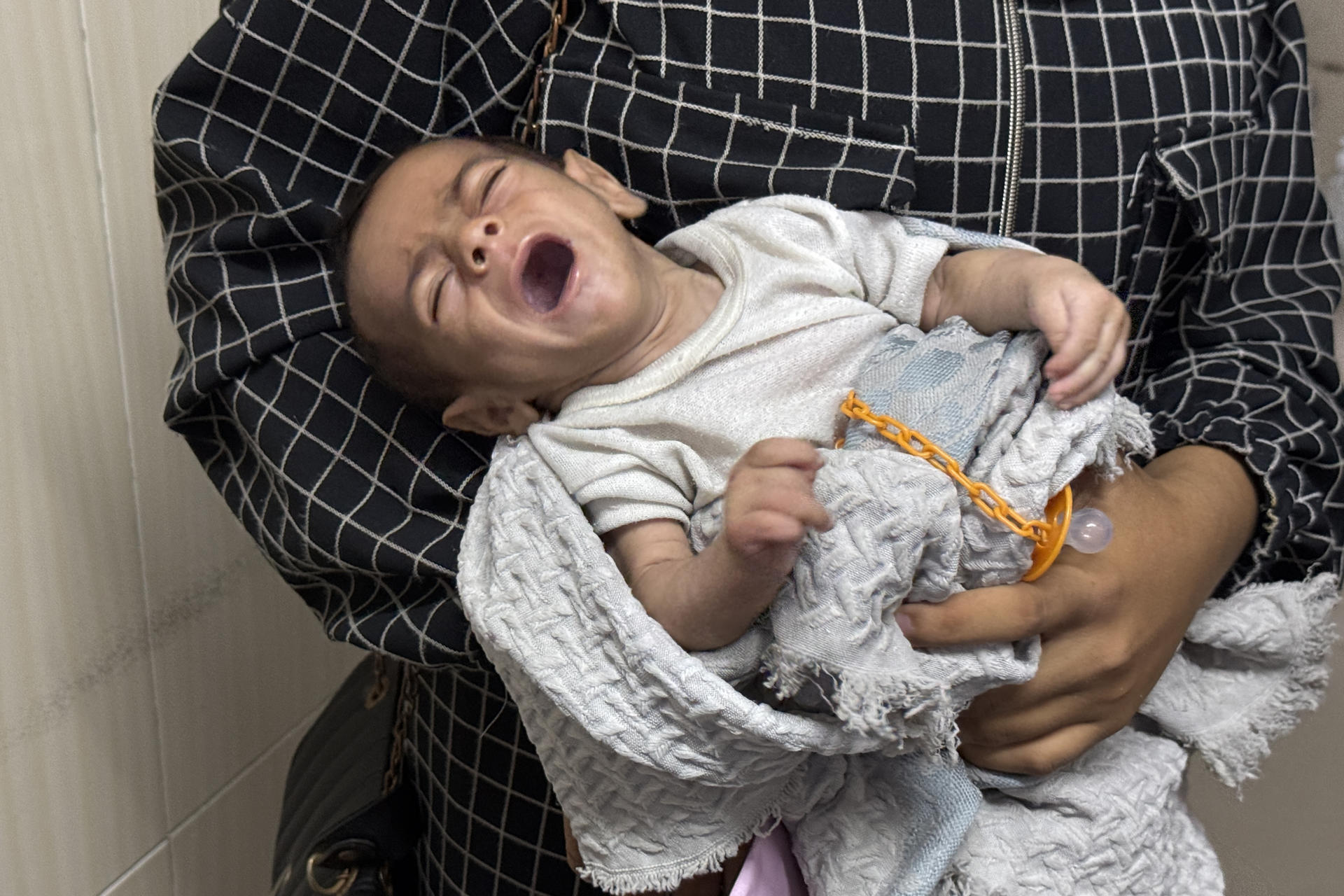 Han muerto más gazatíes por desnutrición en lo que va de 2025 que en los dos años previos
