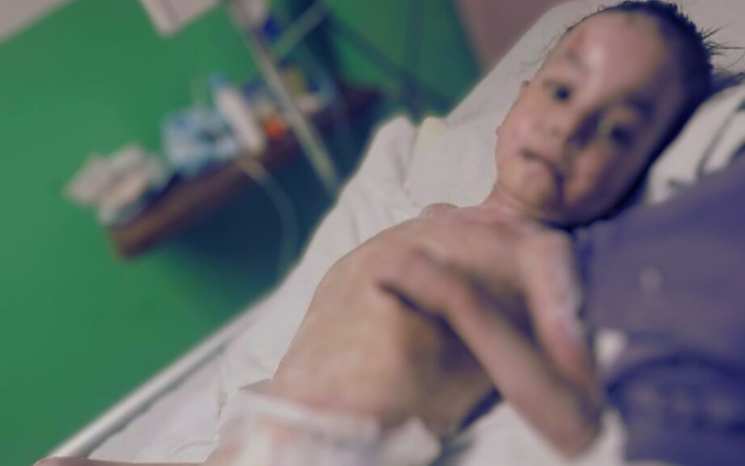 Jonathan, el niño de «piel de cristal» que necesita ayuda en su lucha por vivir