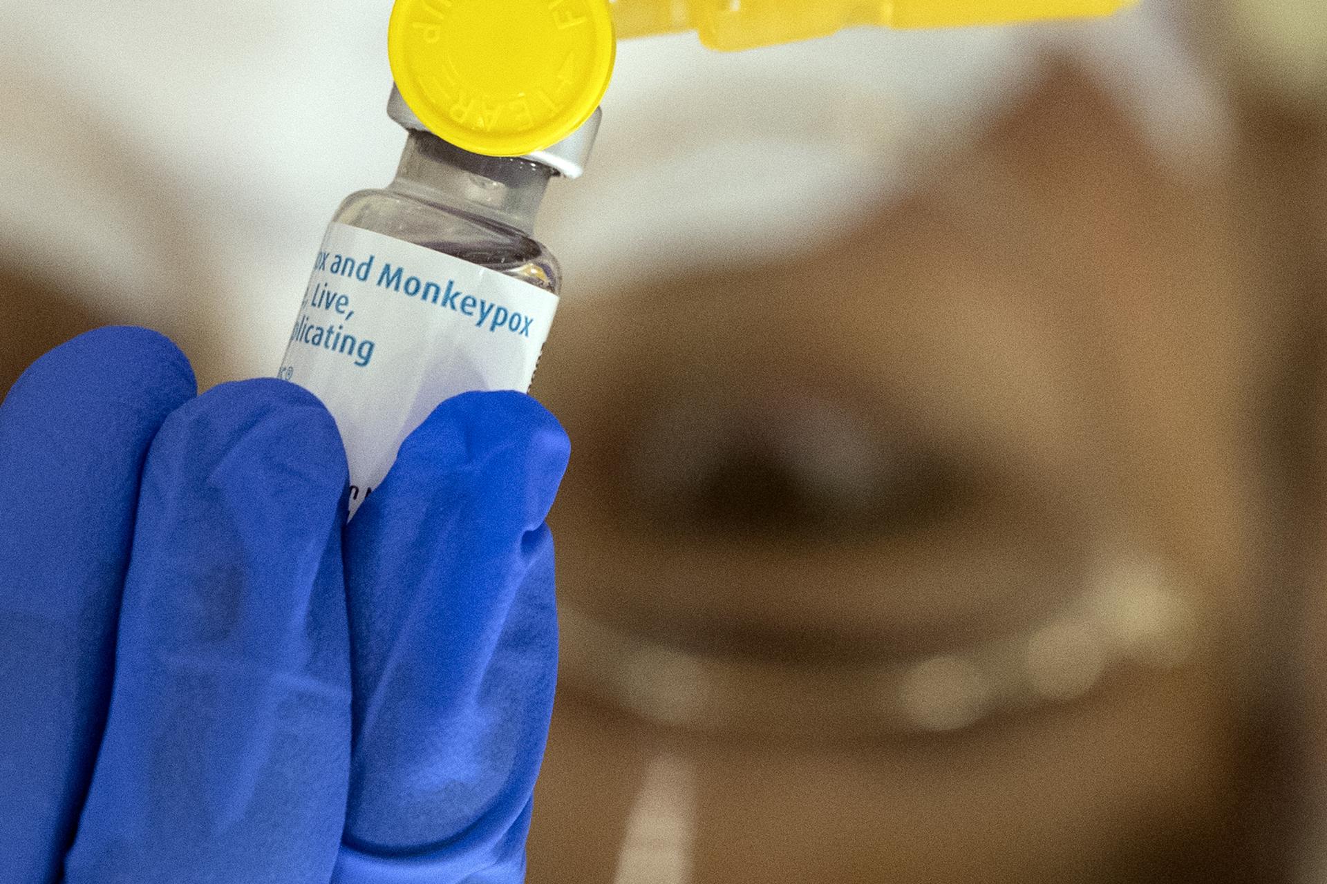 Detectado en Suecia el primer caso de mpox o viruela del mono fuera de África